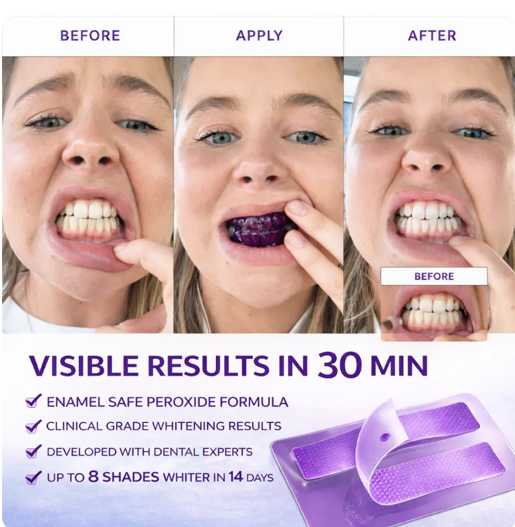 Purple Teeth Whitening Strips
